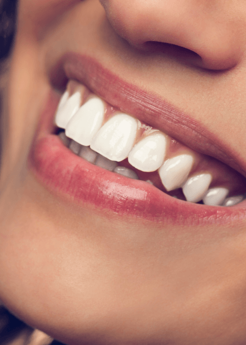 Una imagen de una sonrisa de una mujer con los dientes blancos