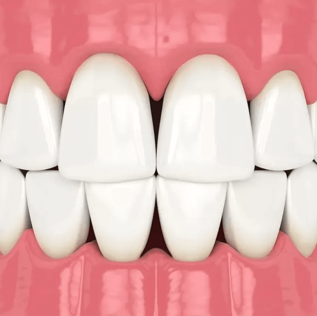 Estaremos encantados de ayudarte a conseguir una sonrisa perfecta.