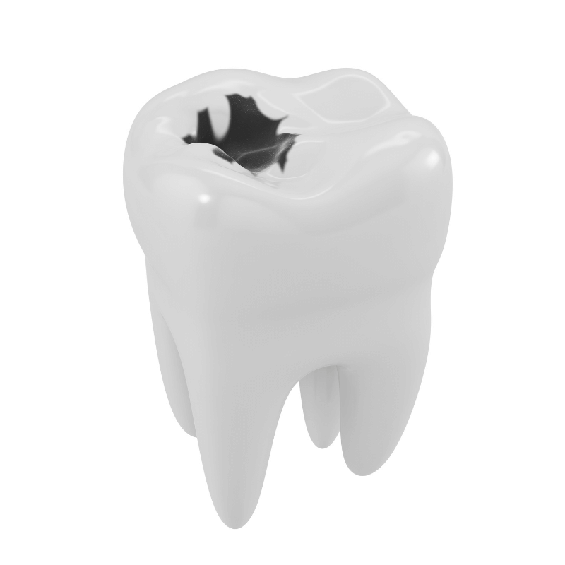 Caries dental ADAME&ESPIGA 01 Caries dental ADAME&ESPIGA 01