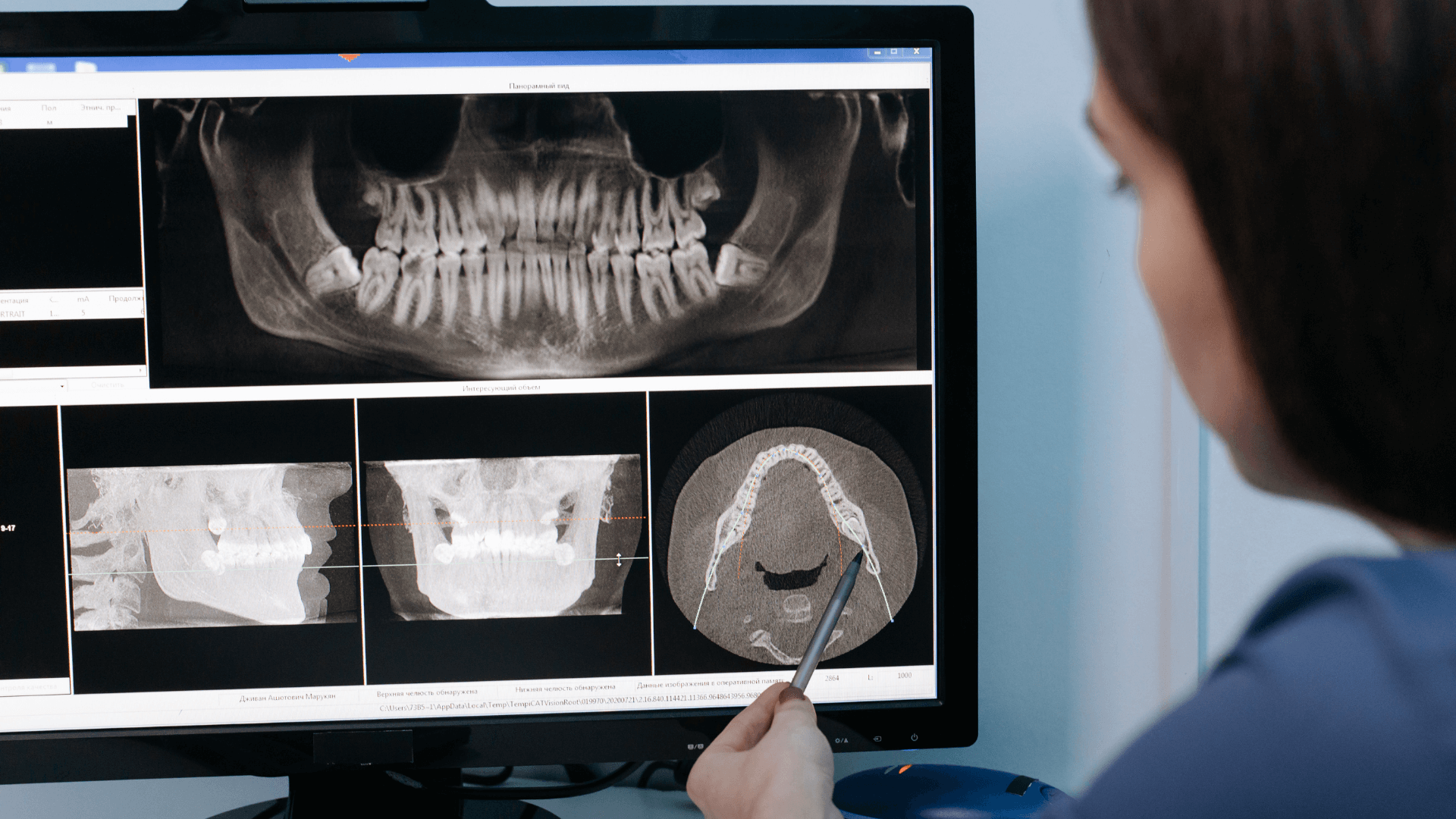 CBCT Adame y Espiga 02