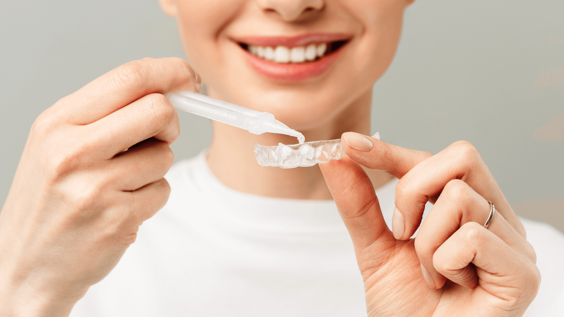 Clinica dental adame y espiga Blanqueamiento dental 01